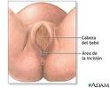 Episiotomia.jpeg
