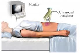 Ultrasonido abdominalP.jpeg