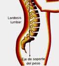 Sacrolumbalgia.jpg