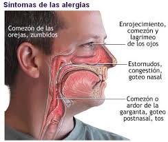 Alergia respiratoria.jpg