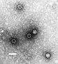 Enterovirus.jpg