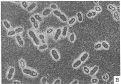 Bacterias Azotobacter.jpg