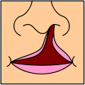 Sindrome johan.png