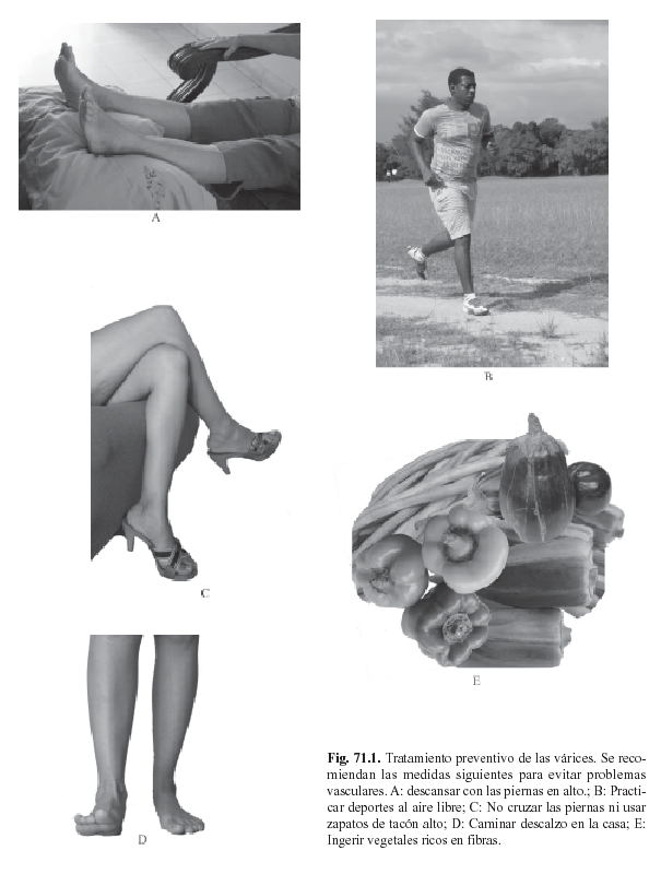 Fig01a71.png