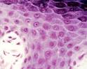 Queratinocitosimages.jpeg1.jpeg