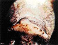 Vesícula intacta sobre la superficie dorsal del hocico de un cerdo.JPG