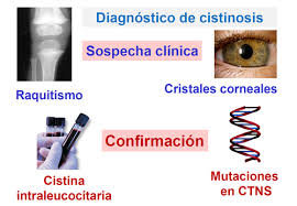 Cistinosis.jpg