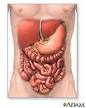 12 hemorragia gastrointestinal.jpeg