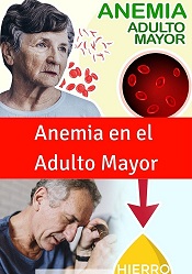 El adulto mayor con anemia .jpg