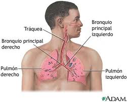 Tuberculosis pulmonal.jpeg