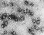 Virus del mosaico de la coliflor.jpg