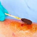 Yoduro de potasio.jpg