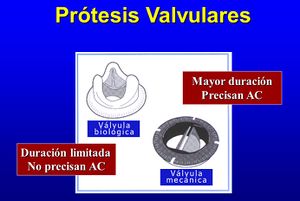 Protesis valvularesa.jpg