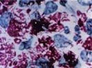 Mycobacterium leprae.jpg
