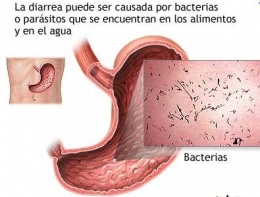 Gastroenteritis1.JPG