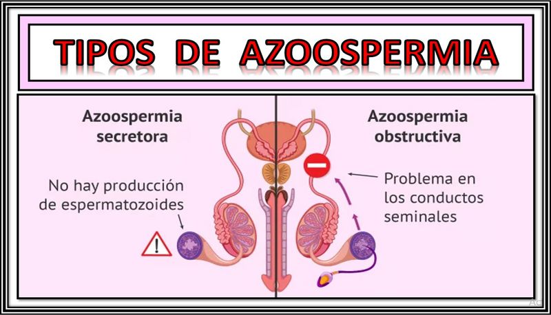 Archivo:Azoospermia.jpg