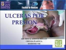 Tratamiento quirurgico de las ulceras por presion.jpg