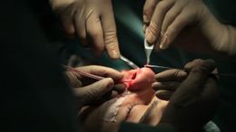 Depositphotos 63817569-stock-video-oral-and-maxillofacial-surgery-the.jpg