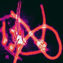 Particulas de Ebola virus.jpg