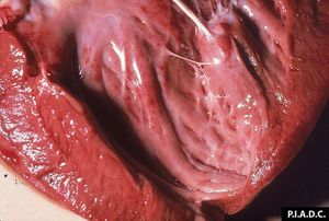 Corazón Hidropericarditis.jpg
