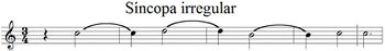 SÍNCOPA IRREGULAR.jpg
