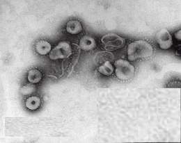 Virus de la bronquitis.jpg