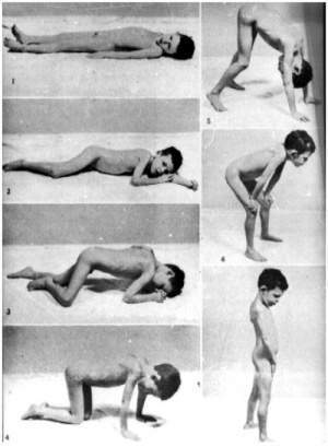 Secuencia que muestra la forma característica de incorporarse un paciente con distrofia muscular progresivaFuente: Roca Goderich R. Tratado de Medicina Interna. T3. Editorial Ciencias Médicas. La Habana; 2002.