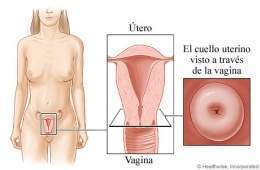 Cuello uterino124.jpg