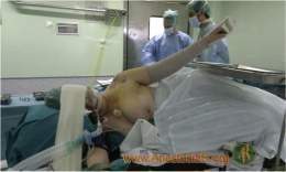 Broncoespasmo durante la anestesia (Small).jpg
