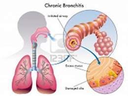 1.- Bronquitis-cronica. (Small).jpg