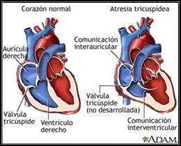 Desarrollo-cardiopatias-congenitas image003.jpg