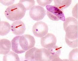 Malaria plasmodium falcipar.jpg