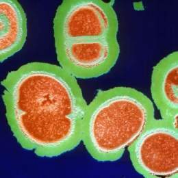 Staphylococcusaureus.jpg