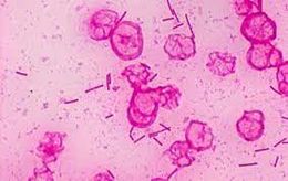 Bacillus macerans.jpg