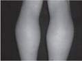 Miniatura de la versión del 10:10 16 feb 2013