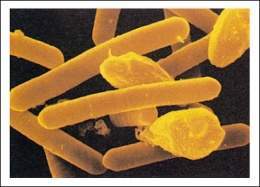 Clostridium.jpg