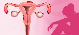 1 Endometriosis.jpg