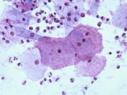 Gardnerella-vaginalis virus.jpg