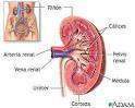 Acidosis renal tubular.jpg