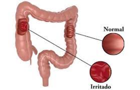 Intestino irritado.jpeg