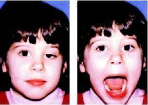 Archivo:SMarcus Gunn.jpg