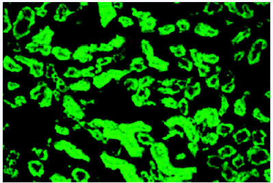 Archivo:Anticuerpo antimitocondrial.gif
