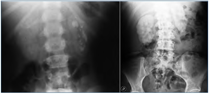 Archivo:2tipo 2.jpeg