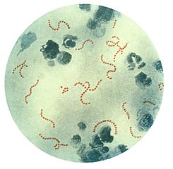 245px-Streptococcus pyogenes 01.jpg