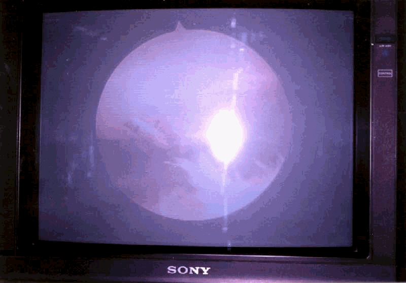 Archivo:CR grado2.gif