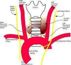 Paralisis bilateral nervios laríng.jpg