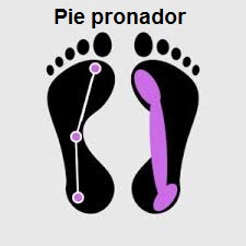 Pie pronador.jpg
