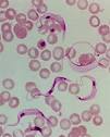 Tripanosomiasis.jpg