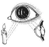 Exploración del paciente en oftalmología.JPG