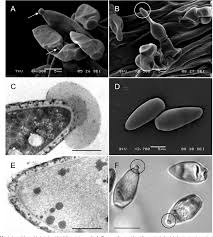 Venturia inaequalis.jpg
